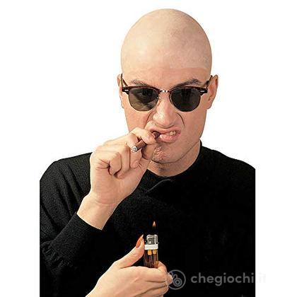 Giovane Calvo Confuso Con Alopecia. Testa Di Pelle Con Perda Di